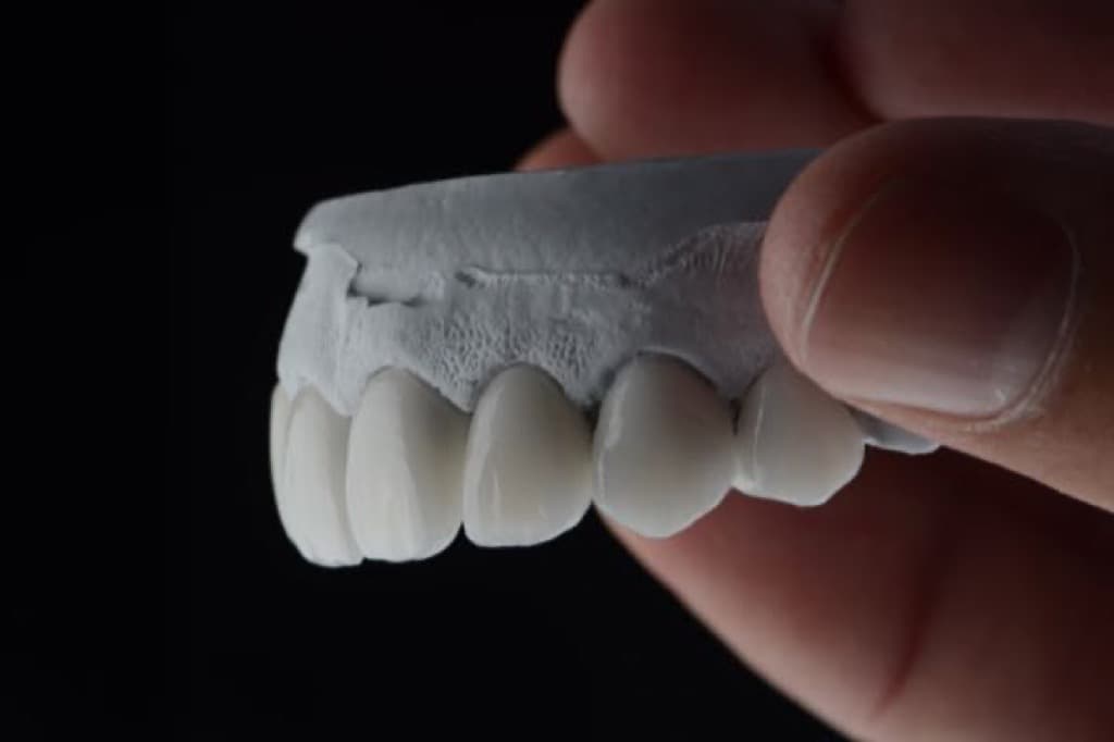 Incisor Crown