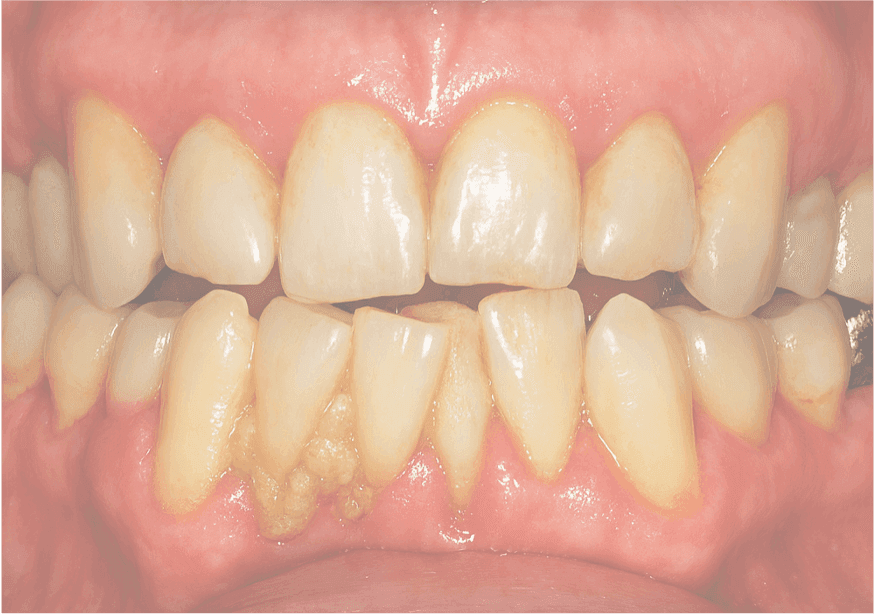 Adult Orthodontics Collaboration