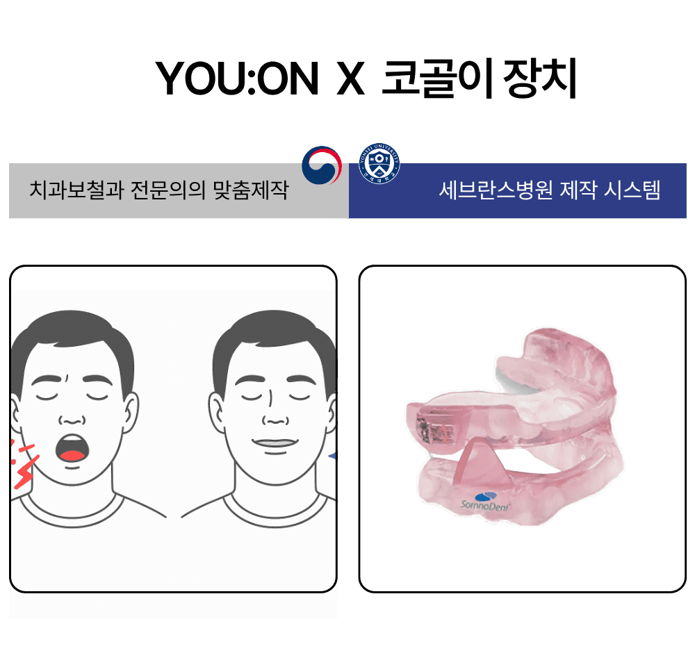 코골이 치료