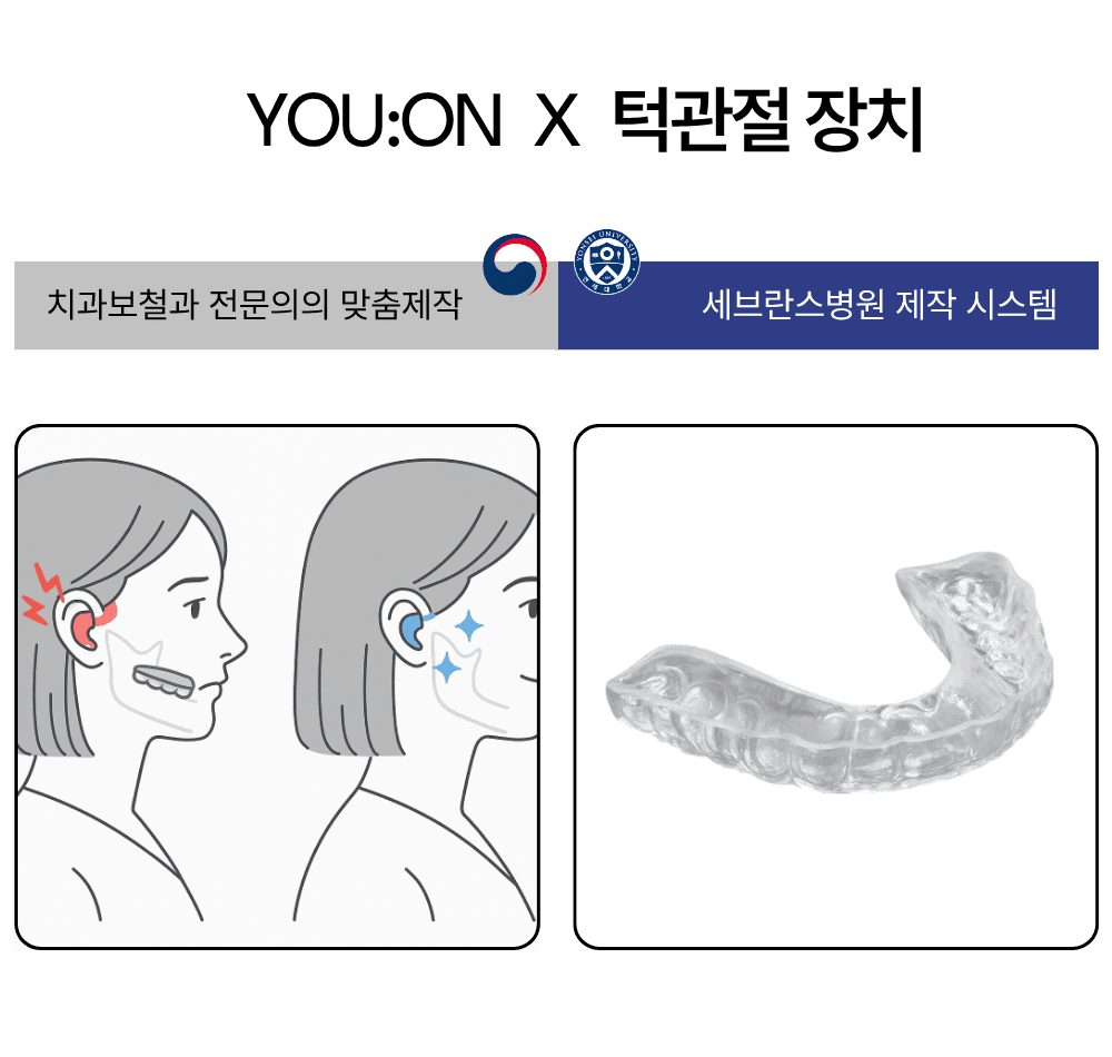 턱관절 장치