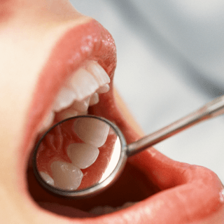 여의도 치과 진료실에서 자주보는
치아가 시린 이유 1) 치아 마모